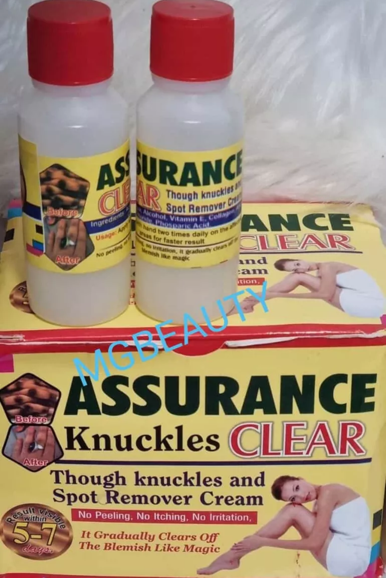 Assurance Dark Knuckles Treatment