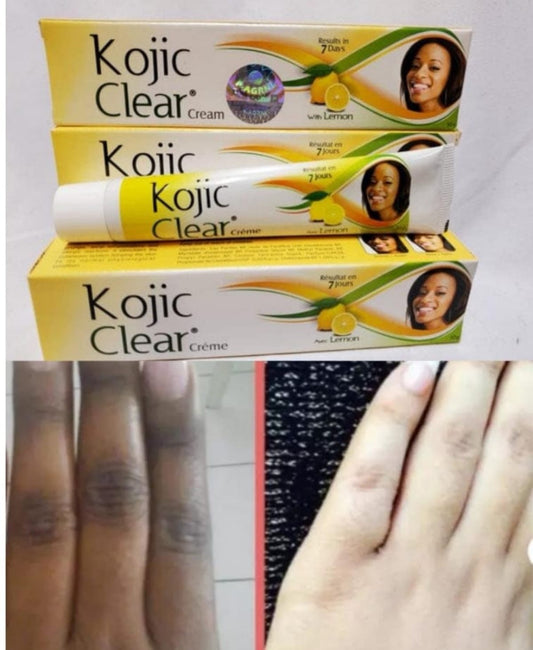 Kojic Clear Lemon Cream