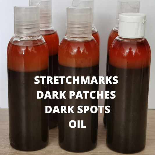 Stretch marks And  Inner Thigh  Treatment Oil 100ml